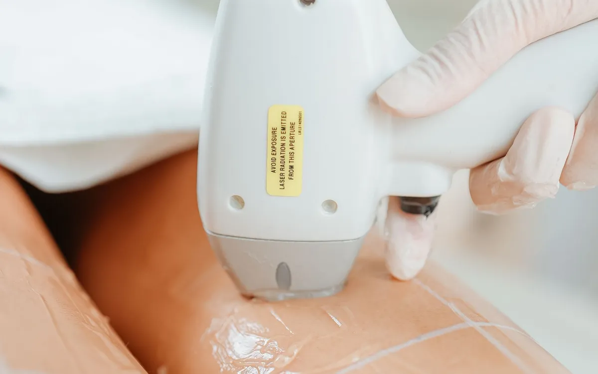 Depilação a laser em clínica